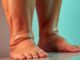 Wassereinlagerungen in den Beinen